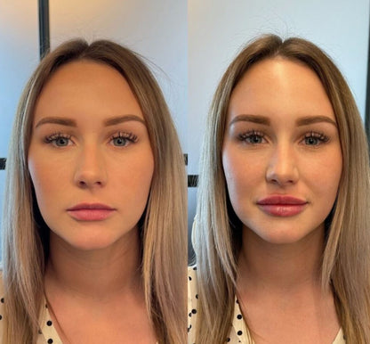 Plumpande Läppserum för Lystra Läppar™